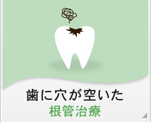 歯に穴が空いた　根管治療
